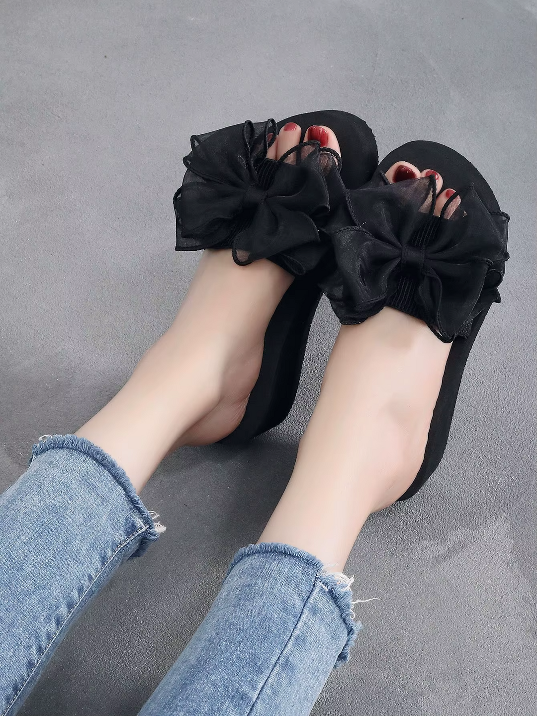 Mireia® - Orthopaedic Sandals | Premium Edition